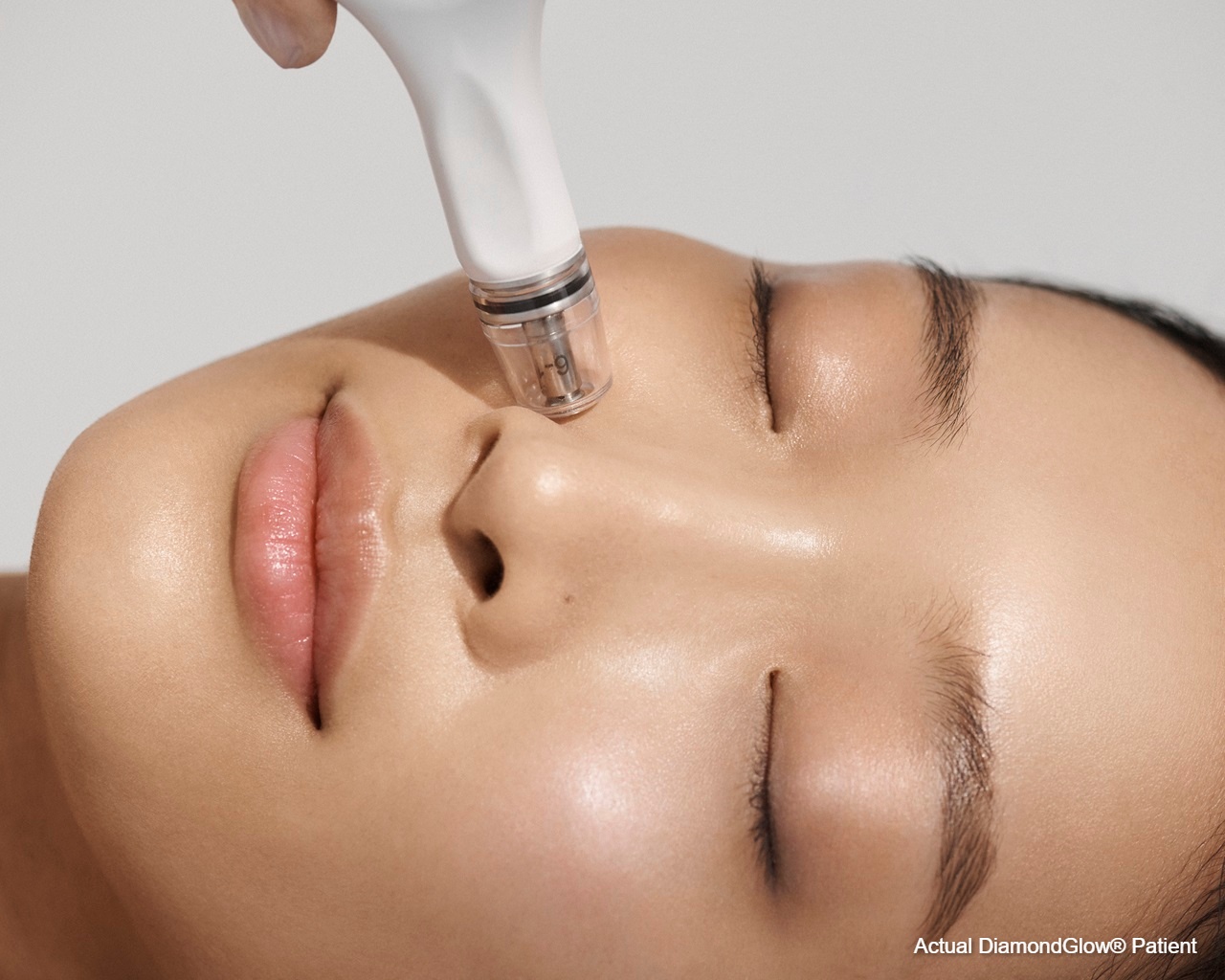Levulan PhotoDynamic Therapy - South Shore Dermatology | Dermatology About Flexile Classic